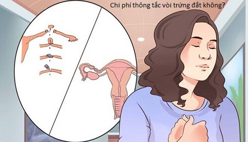 Chi phí thông tắc vòi trứng đắt không?